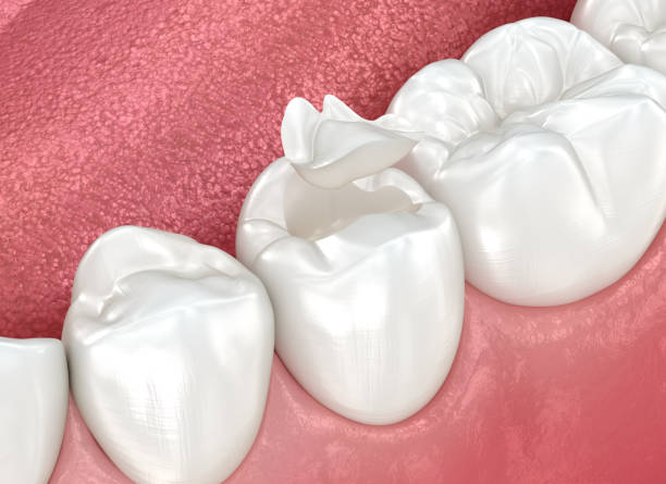 Best Dental Studio in Los Ranchos, CA